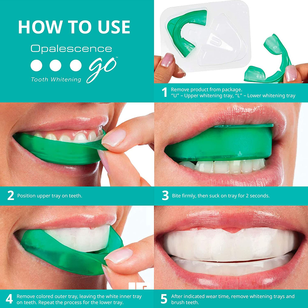 Nadtlenek wodoru do wybielania – Teeth Whitening With Peroxide recenzja i cena