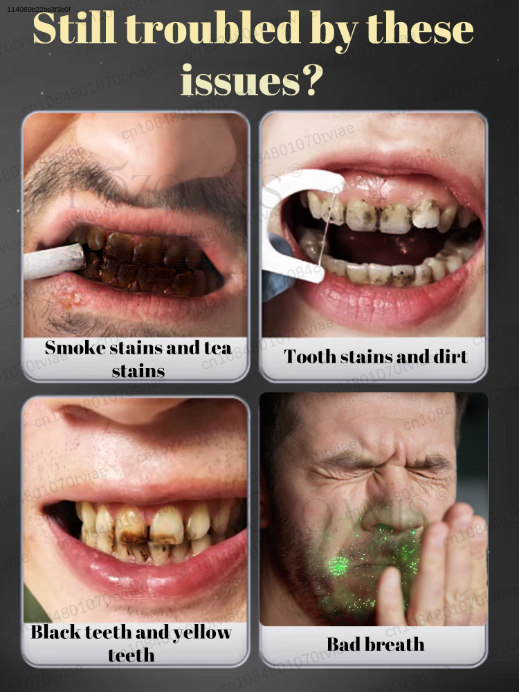 POZOAMIS 30% Hydroxyapatite Pa – Teeth Whitening Best recenzja i cena