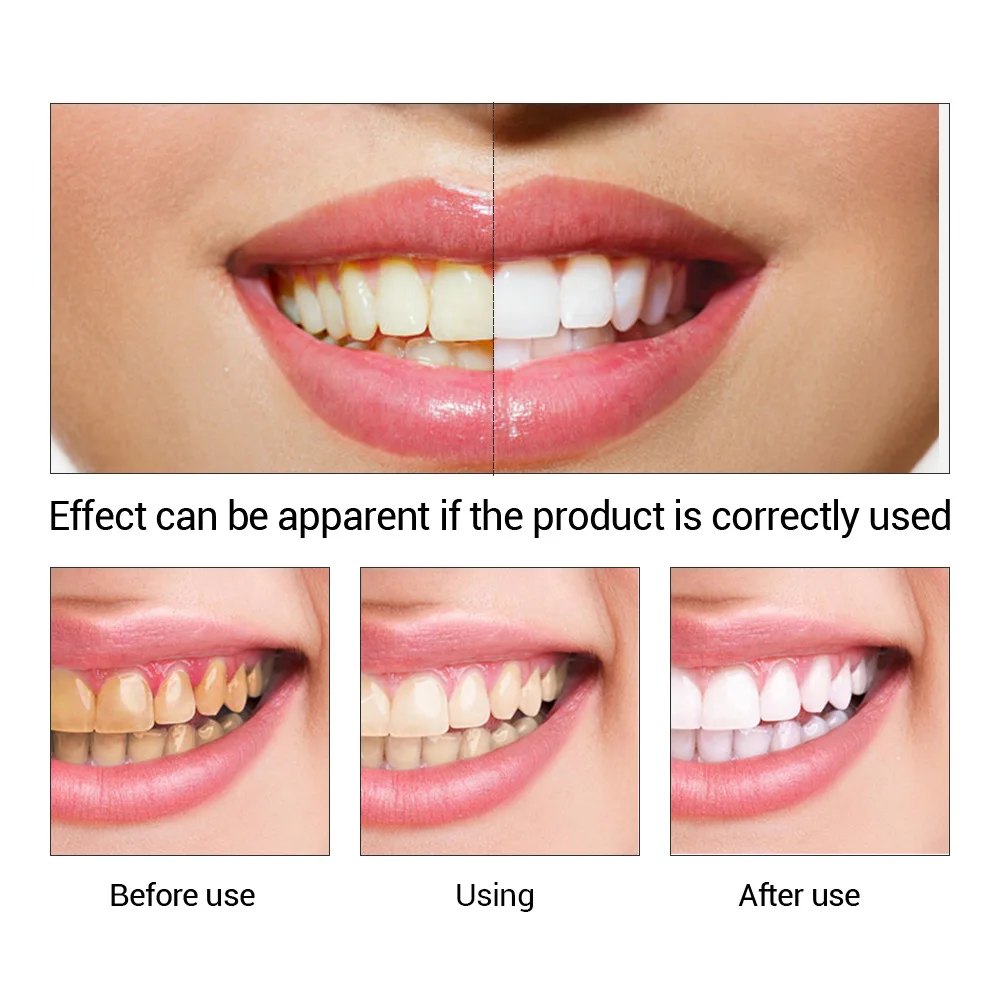 FTEENPLY esencja do wybielania – Teeth Whitening Best recenzja i cena