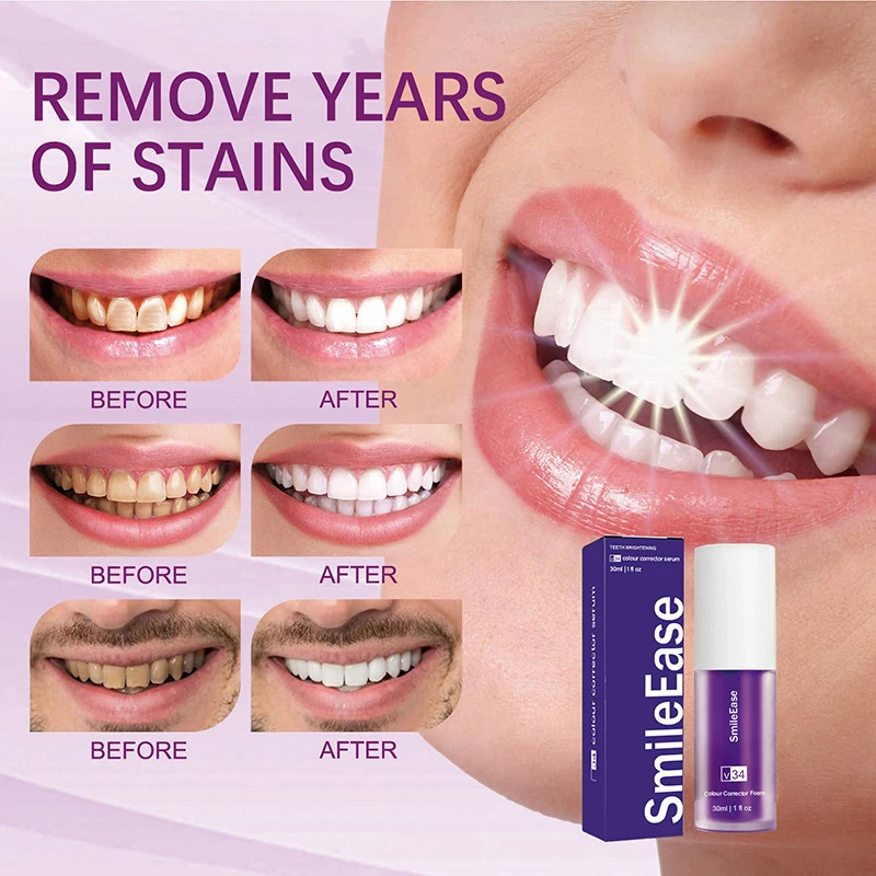 45ml Smilekit Purple Tooth Mou – Teeth Whitening Best recenzja i cena