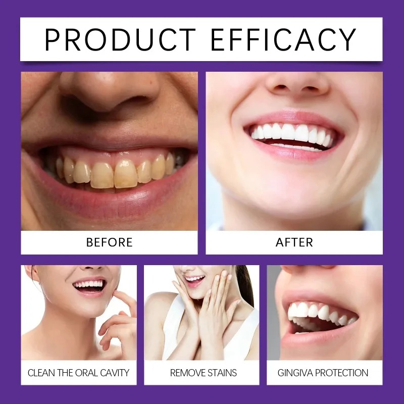 Fioletowy proszek mineralny do – Teeth Whitening Best recenzja i cena