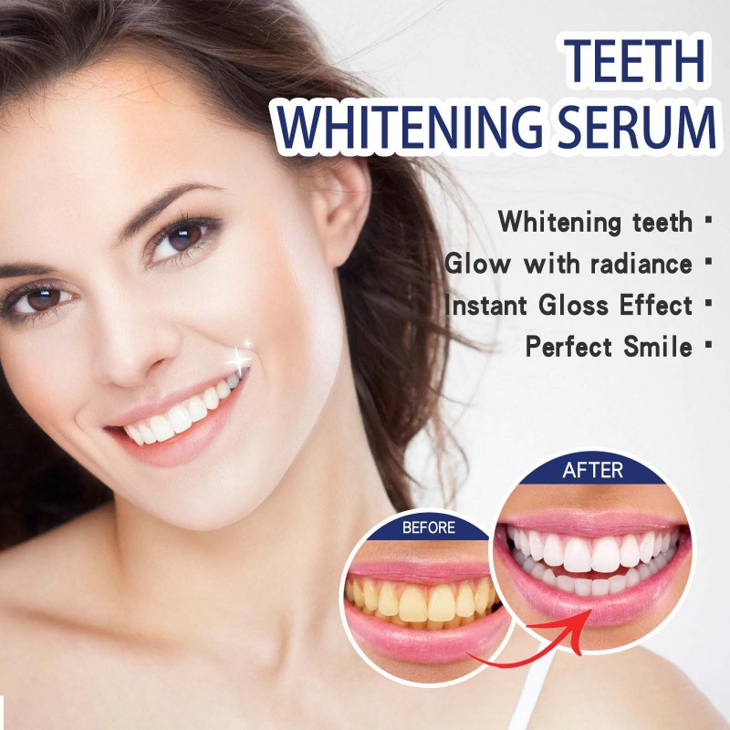 Profesjonalne serum do wybiela – Teeth Whitening With Peroxide recenzja i cena