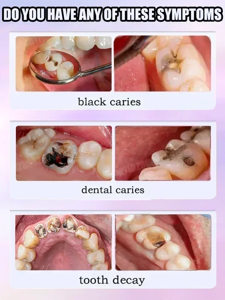 Czyszczenie zębów Pasta do zęb – Teeth Whitening Best recenzja i cena